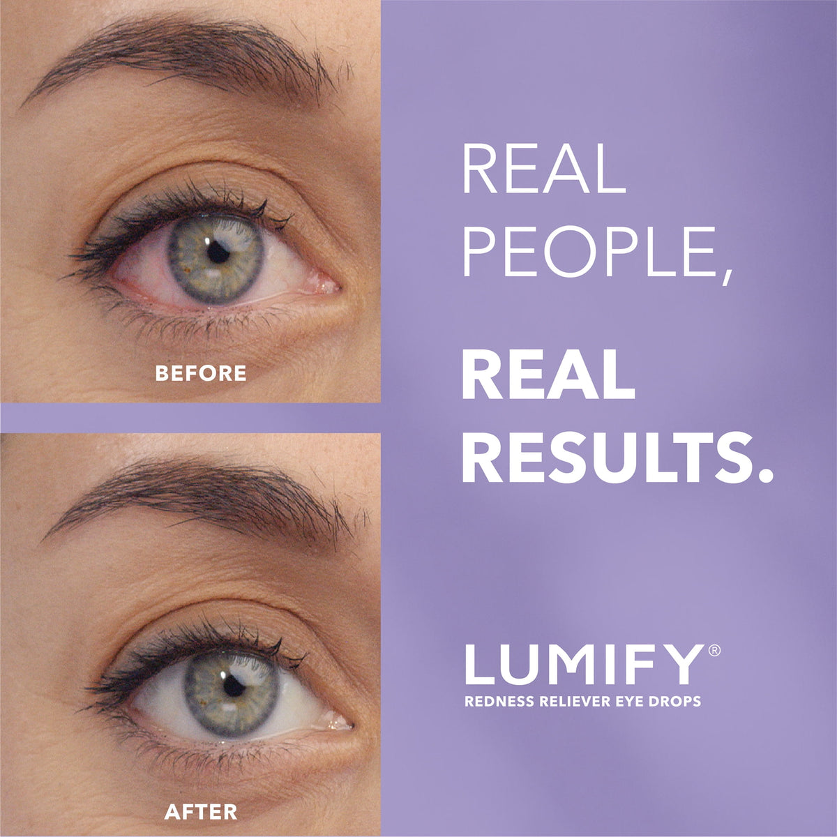 LUMIFY Eye Drops for Redness Relief and Whiter and Brighter Looking Eyes, .25 fl oz (7.5 ml)