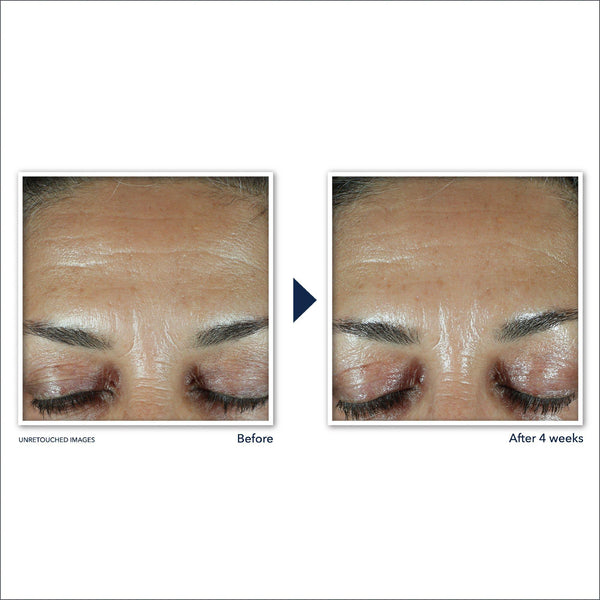 Retinol Correxion Anti-Wrinkle Retinol Face Serum with Hyaluronic Acid