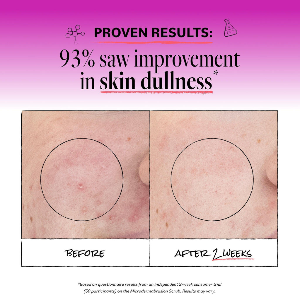 Microdermabrasion Scrub
