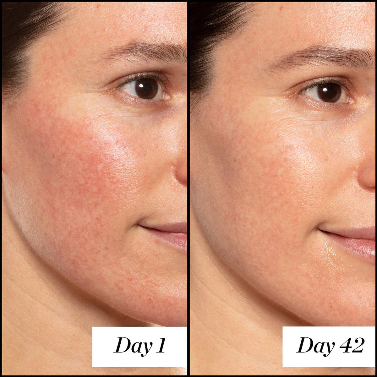 A+ High-Dose Retinoid Serum
