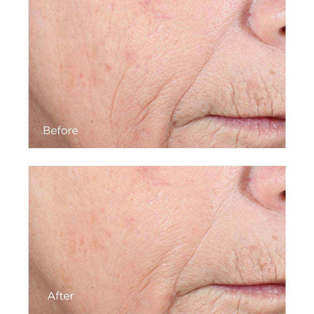 Vitamin C Ester CCC+ Ferulic Brightening Complex 20%