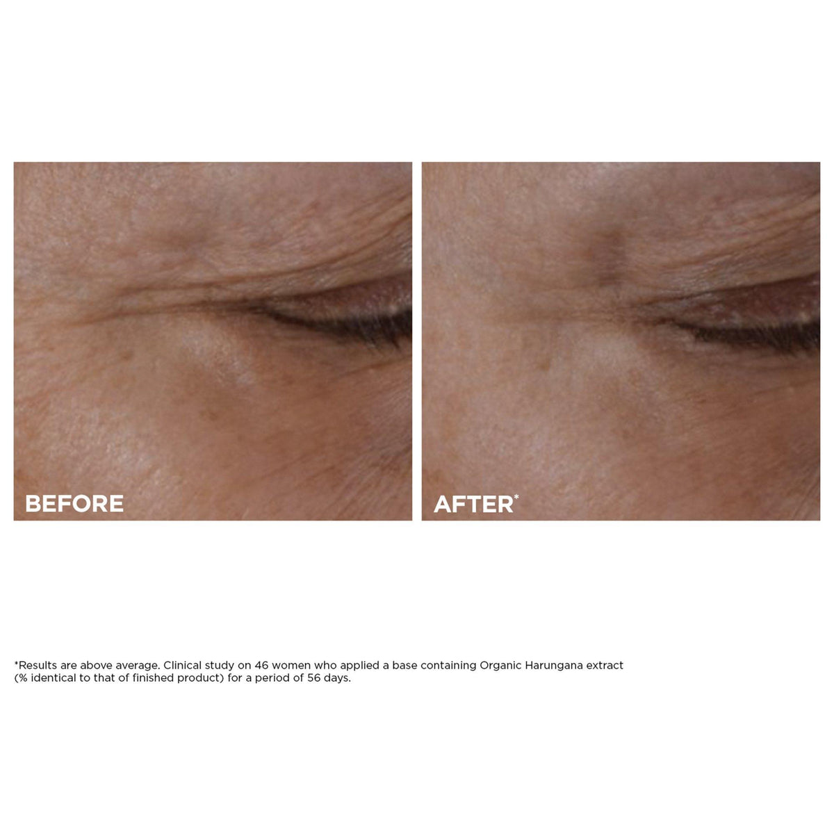 Total Eye Lift Refillable Eye Cream