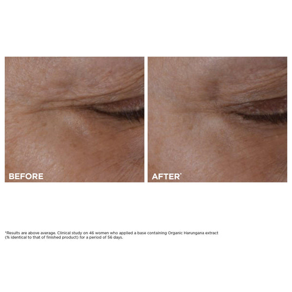Total Eye Lift Refillable Eye Cream