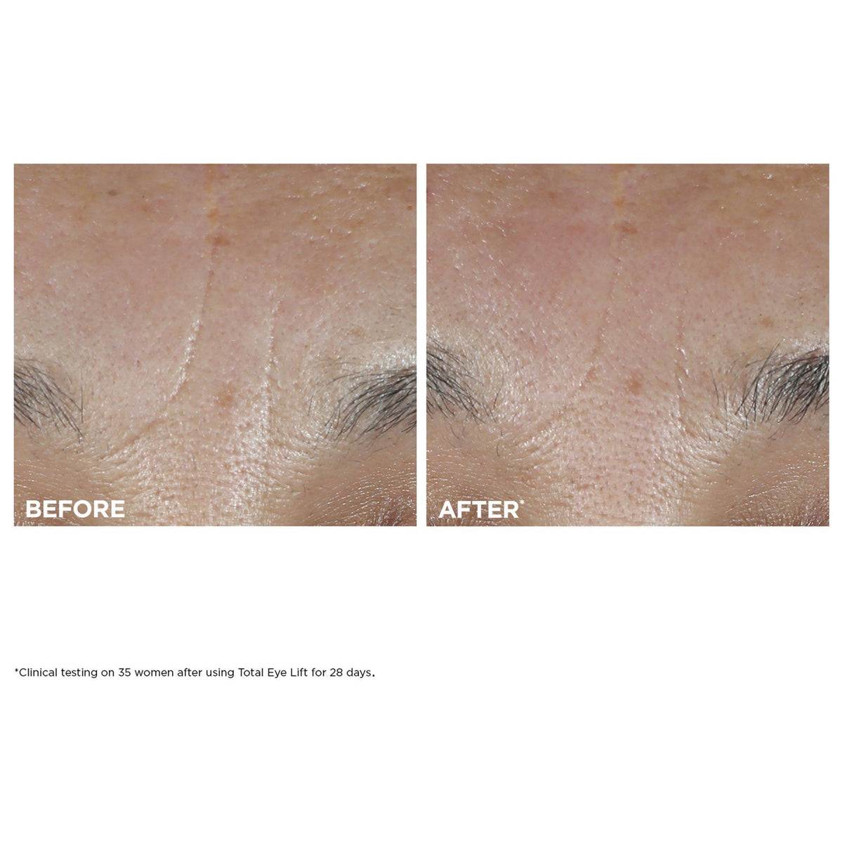 Total Eye Lift Refillable Eye Cream