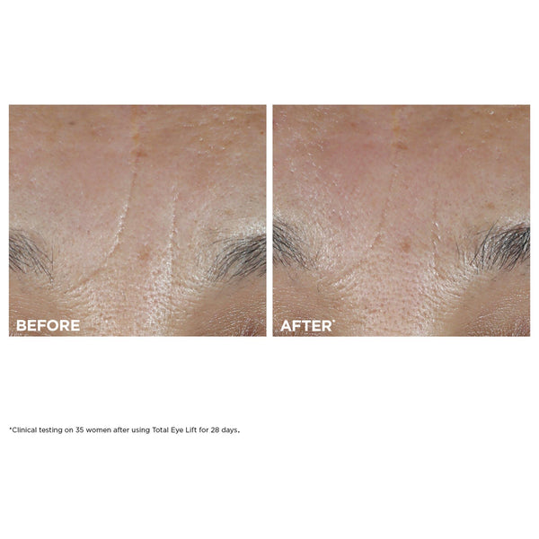 Total Eye Lift Refillable Eye Cream