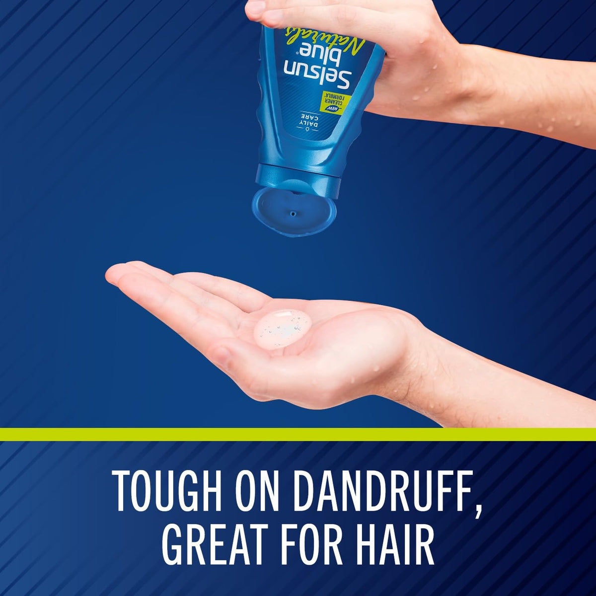 Selsun Blue Naturals Itchy Dry Scalp Antidandruff Shampoo, 11 fl. oz.