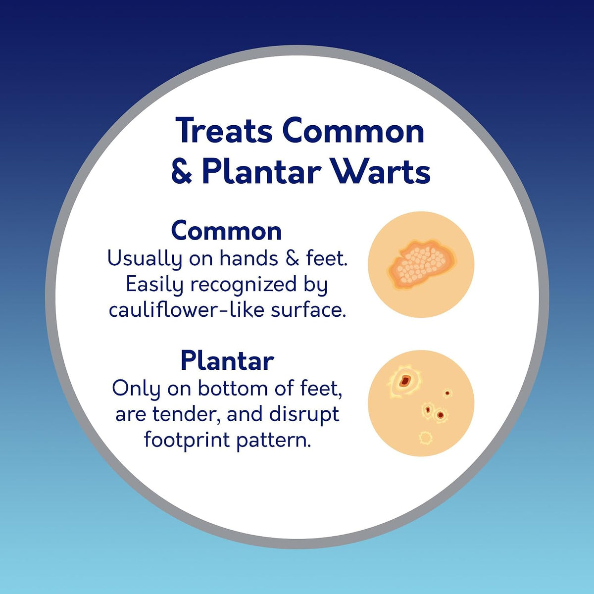Compound W Maximum Strength Gel & ConSeal Wart Remover Kit