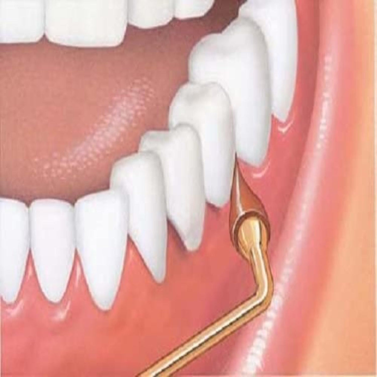 GUM Stimulator Permanent Handle with Rubber Tip, 1 Count