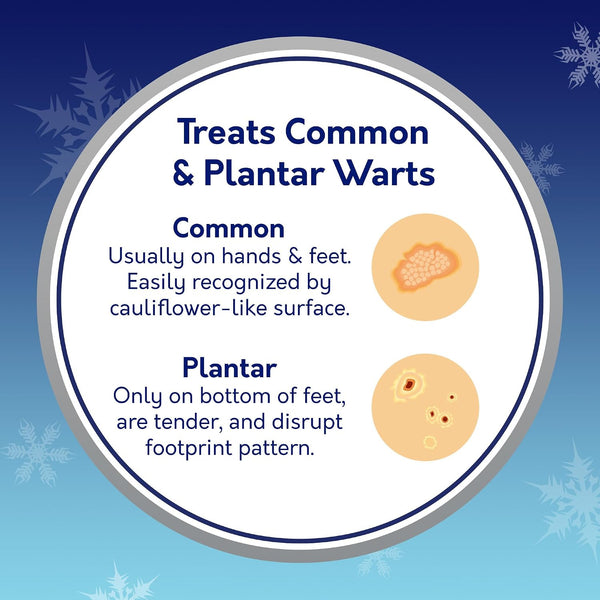Compound W Freeze Off Wart Remover, 8 Applications