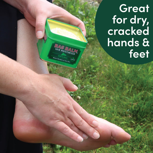 Vermont’s Original Bag Balm, Skin Moisturizer for Dry Skin, 8oz Tin