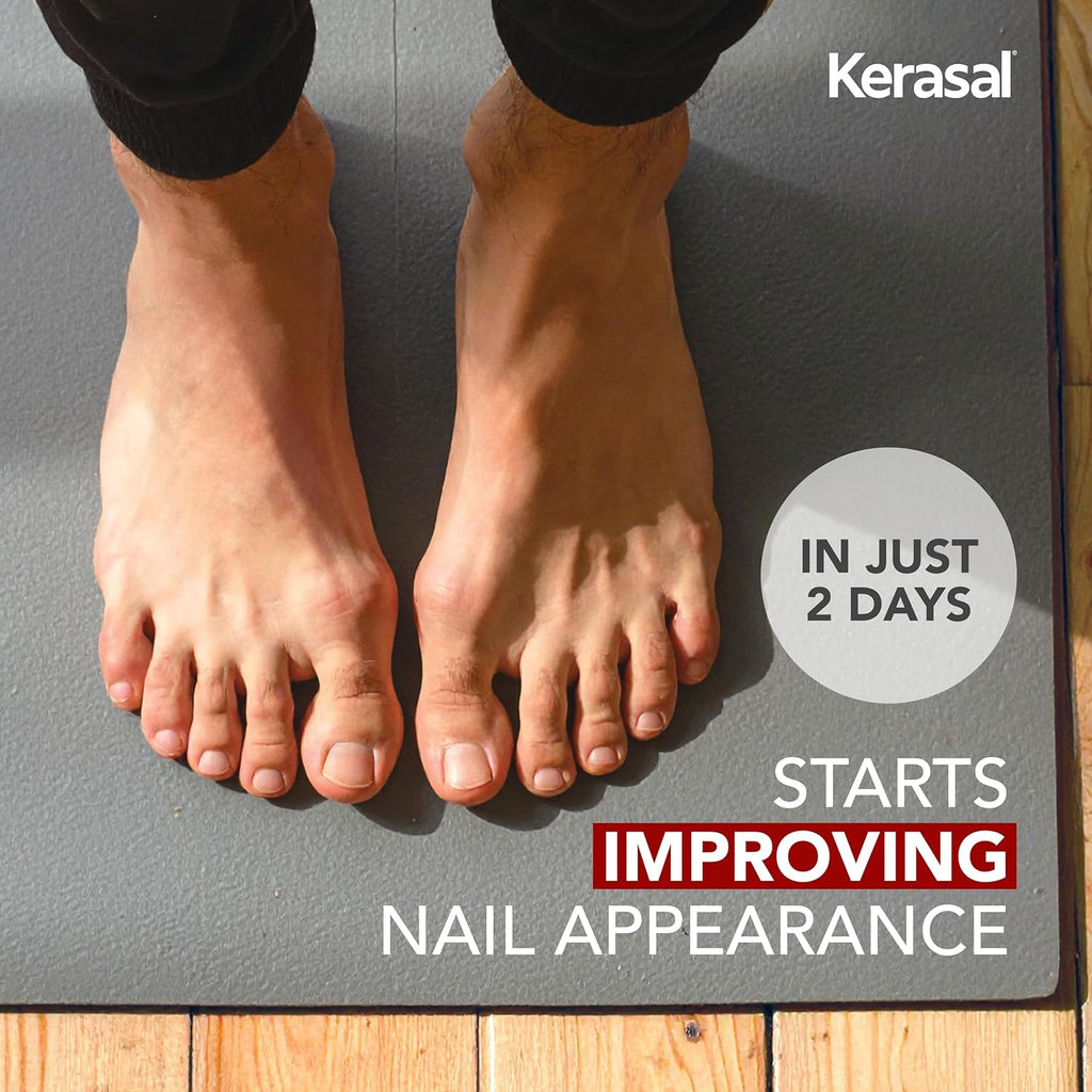 Kerasal Fungal Nail Renewal, Restorative Repair for Damaged Nails, .33 oz