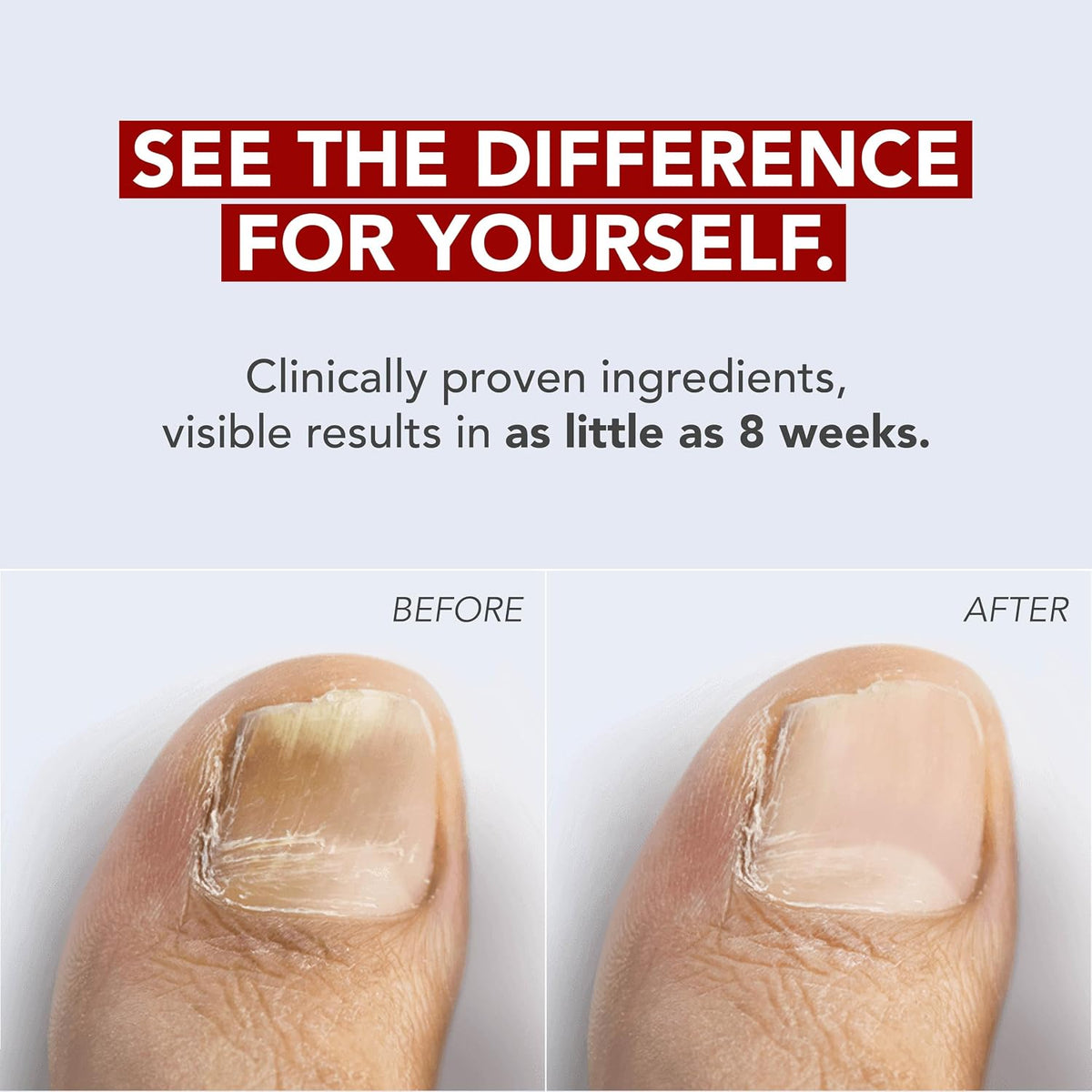 Kerasal Fungal Nail Renewal, Restorative Repair for Damaged Nails, .33 oz