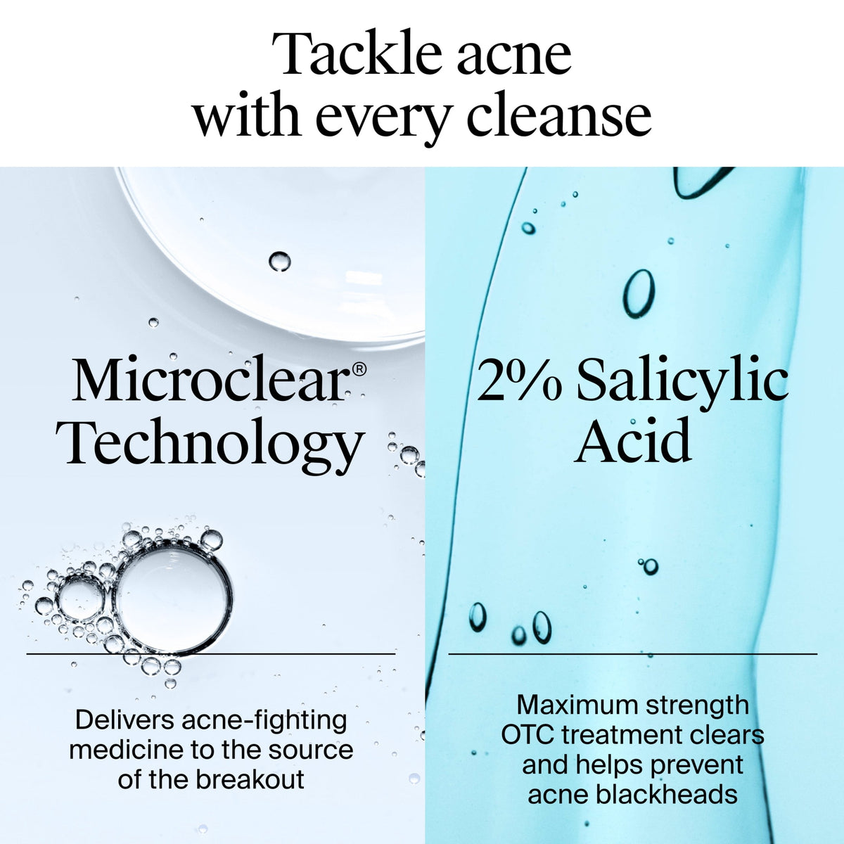 Neutrogena Acne Stress Control Face Toner, Acne Treatment with Salicylic Acid, 8 fl oz