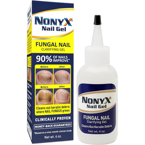 NONYX Fungal Nail Clarifying Gel | Clinically Proven for Discolored, Thick, Brittle, Yellow, Lifted, and other signs of Fungus-Damaged Toenails | 90%