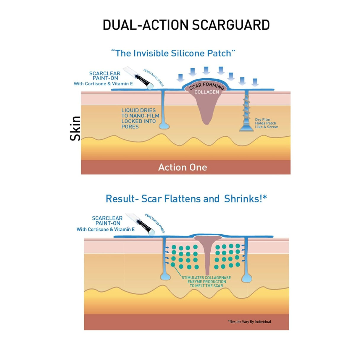 Scarguard - Invisible Brush-On Silicone Sheet with Vitamin E - Scar Removal for Keloids, Burn Scars, Surgery Scars, Stitches, Cuts - No Ugly Scar