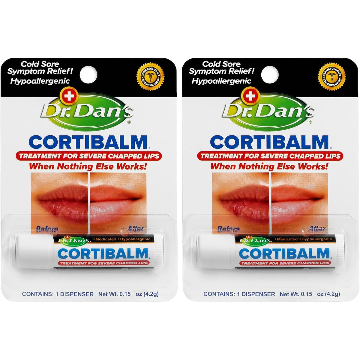 Dr. Dan's Cortibalm 1-Pack Lip Balm with 1% Hydrocortisone for Cracked Lips