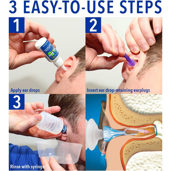 Mack's ProRinse Ear Wax Removal System - 0.5 FL OZ Ear Drops, Ear Plugs, Ear Wash Tub & Ear Syringe with Triple-Action Rinse Tip