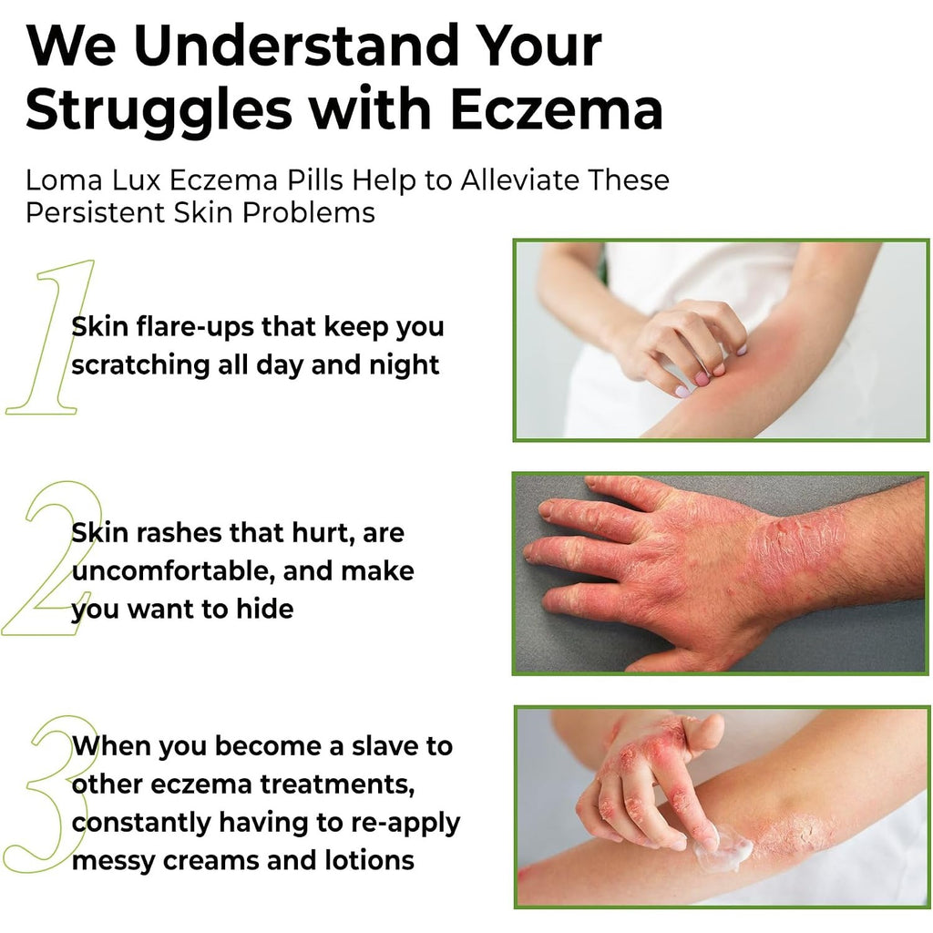 Loma Lux Eczema Pills for Rash & Itchy Skin Relief with 7 Minerals,60 Ct