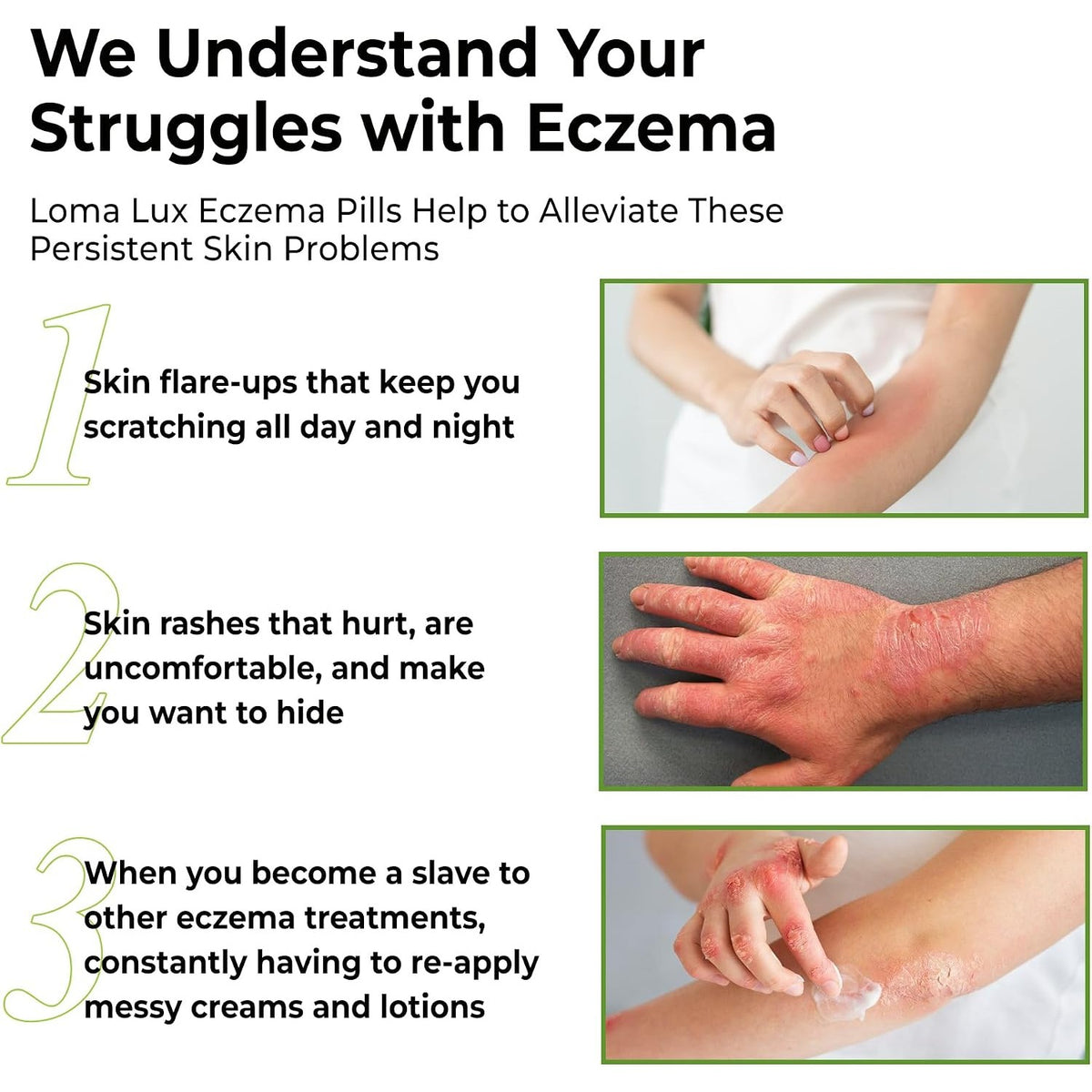 Loma Lux Eczema Pills for Rash & Itchy Skin Relief with 7 Minerals,60 Ct