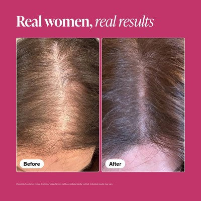 Viviscal Women's Hair Growth Supplement - 60ct