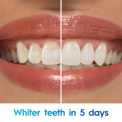 Crest 3D White Advanced Charcoal Teeth Whitening Toothpaste