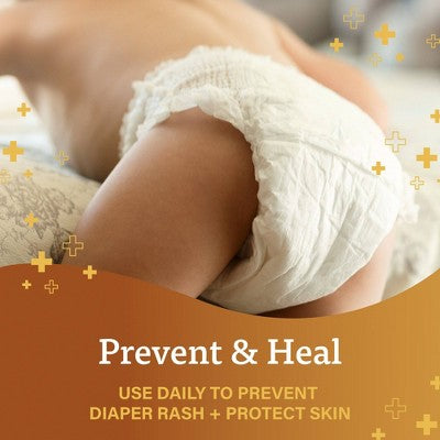 A+D Baby Diaper Rash Ointment, Baby Protectant with Vitamins A and D