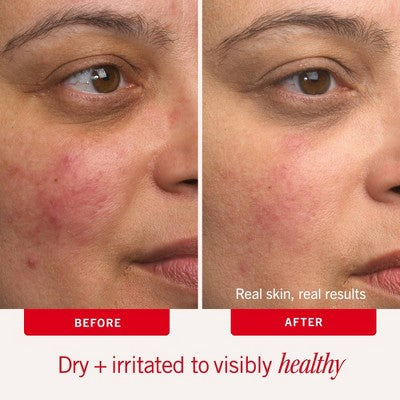 FIRST AID BEAUTY Ultra Repair Cream with Colloidal Oatmeal - 4.0oz - Beauty Studio