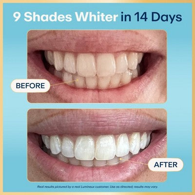 Lumineux Tooth Whitening Strips - 14pk