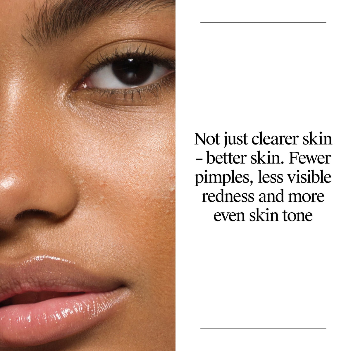 Neutrogena Oil-Free Acne Face Wash, Salicylic Acid Facial Cleanser & Acne Treatment, 9.1 fl oz