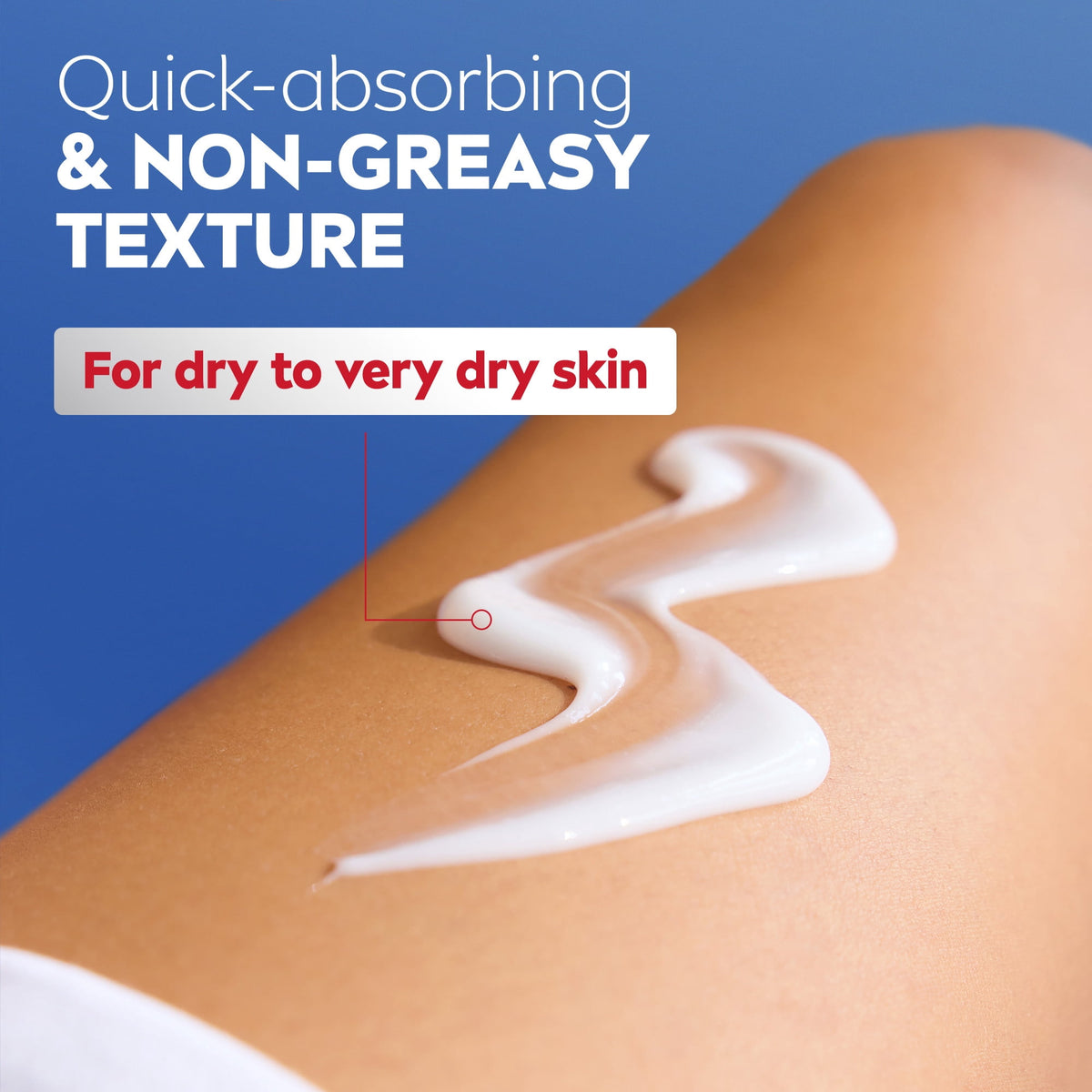 NIVEA Intense Healing Body Lotion for Very Dry and Itchy Skin, 72Hr Moisturizer, 20 fl oz